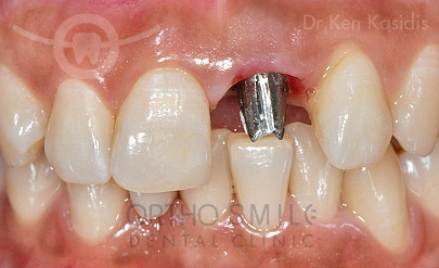 orthosmile_sr_dental_imgc.jpg