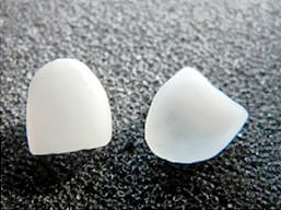 Porcelain Veneers / Dental Veneers